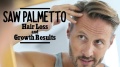 SAW-PALMETTO-EXTRACT-320MG--90-kaps-NOW-FOODS.jpg